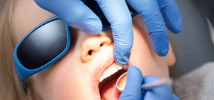 Oral cancer screening in San Luis Obispo