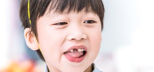 Child without tooth in San Luis Obispo