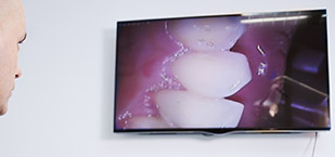 Intraoral images